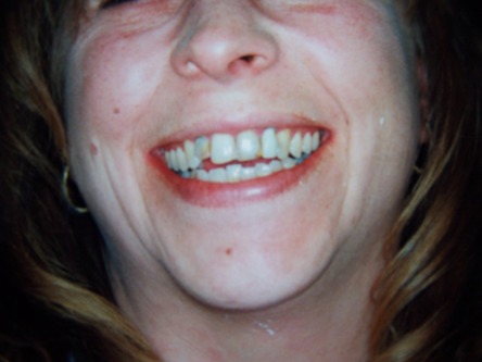 Esthetic dentistry by Mark Dennis,DDS