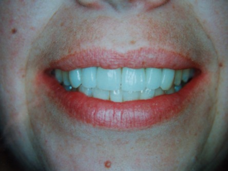 Esthetic dentistry by Mark Dennis,DDS